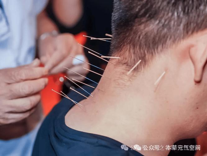 洛阳特色针灸培训班