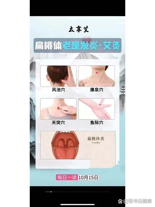 扁桃体发炎针灸穴位