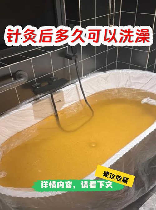 针灸完当天能洗澡吗