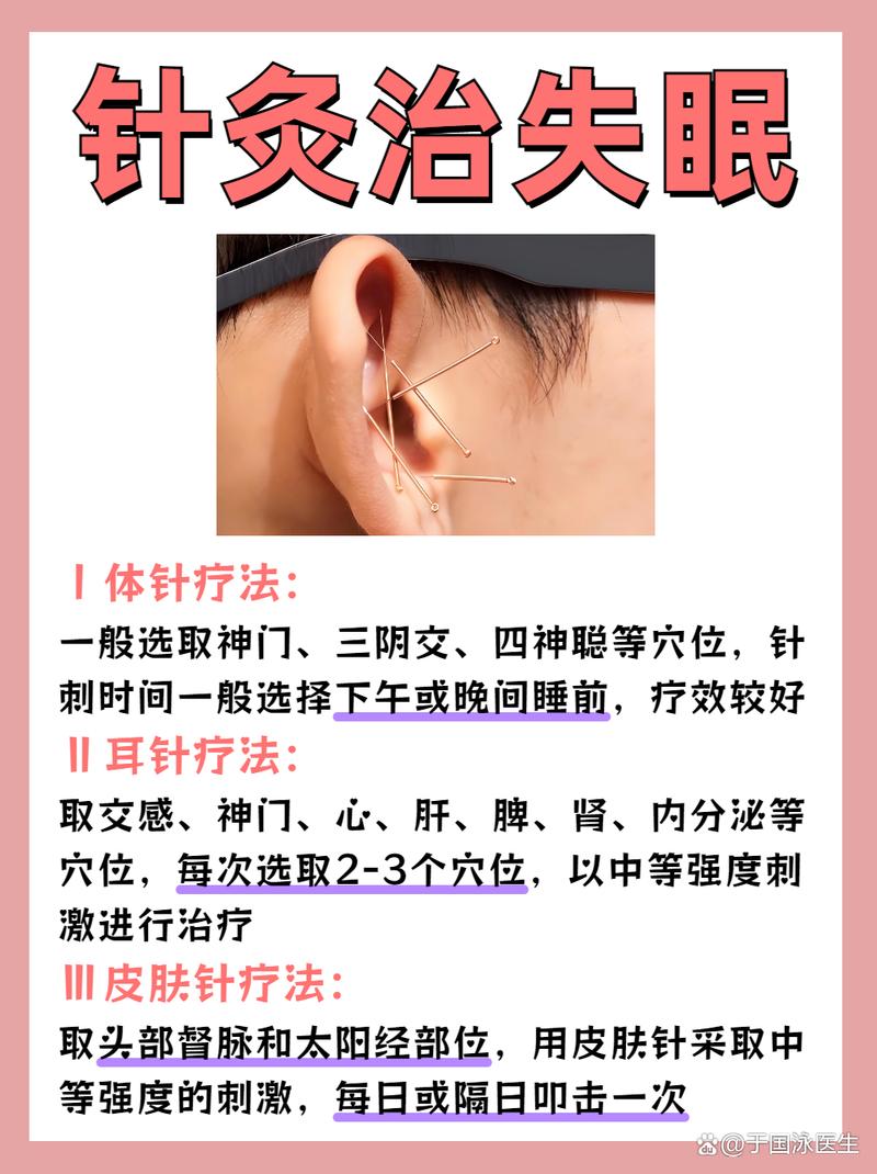 针灸治失眠效果如何