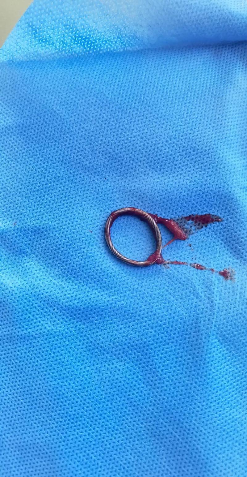 现在哪种环最好最安全