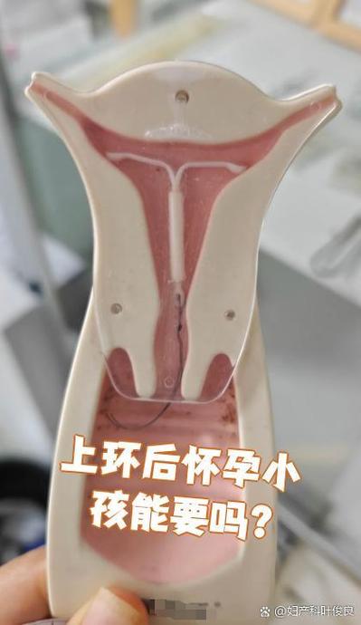 现在哪种环最好最安全