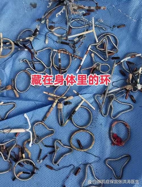 现在哪种环最好最安全