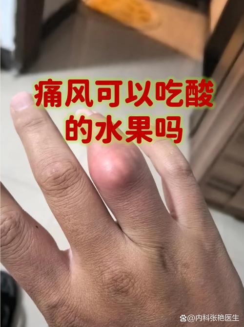 痛风可以吃白砂糖吗
