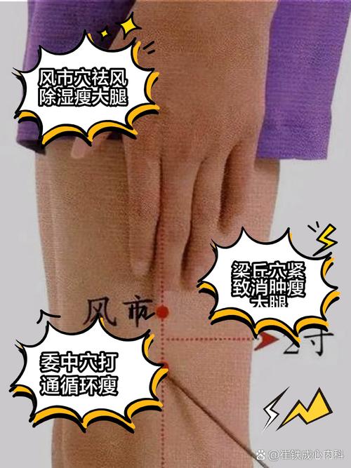 针灸减肥的穴位在哪