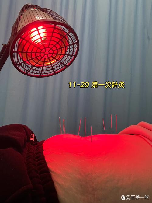 圣爱中医馆针灸减肥