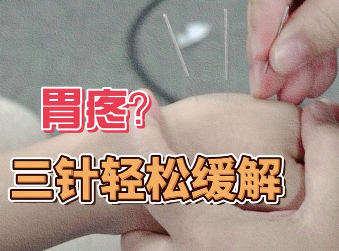 胃疼的针灸治疗方法