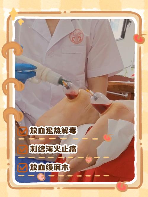 用针灸针治疤痕放血