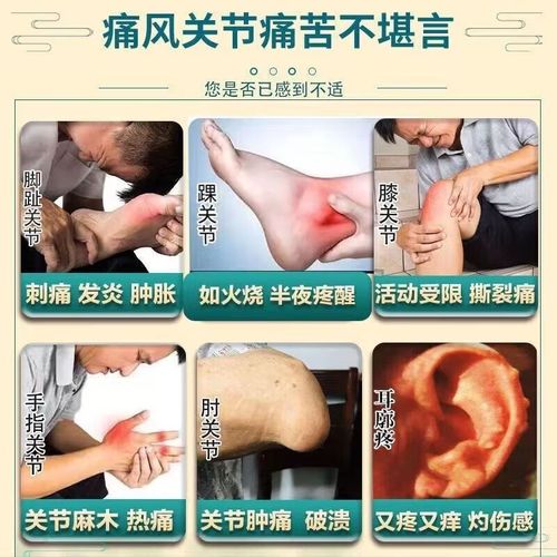 痛风石能热水泡脚吗