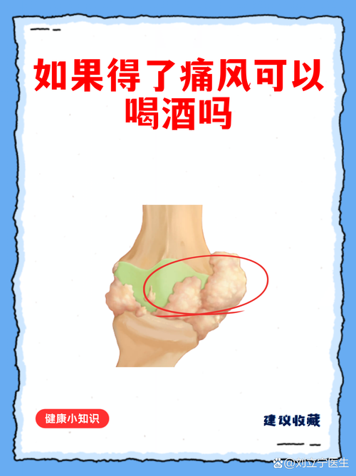 喝酒会不会引起痛风