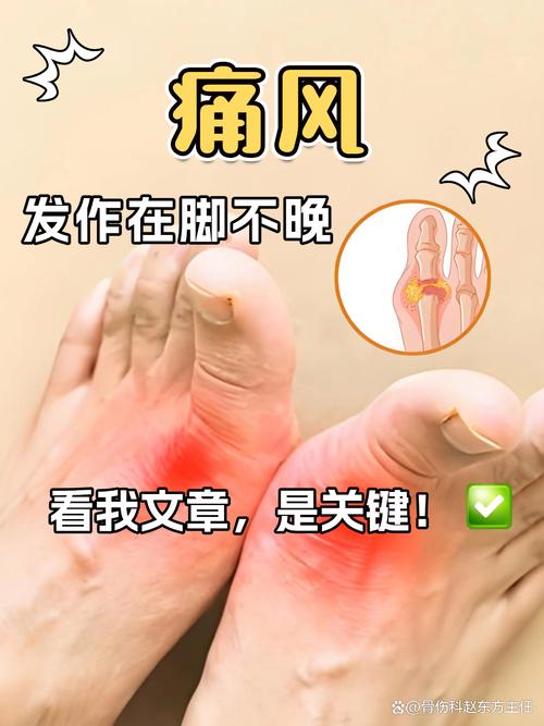 脚小拇指疼是痛风吗