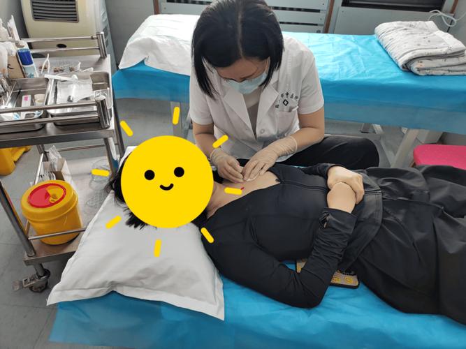 乳腺囊性增生针灸图