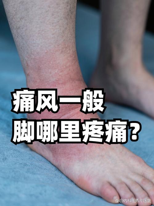 喝完酒脚酸是痛风吗