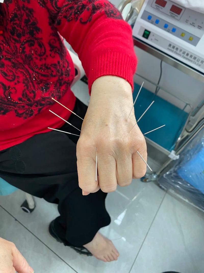 东邦针灸针在哪进吗