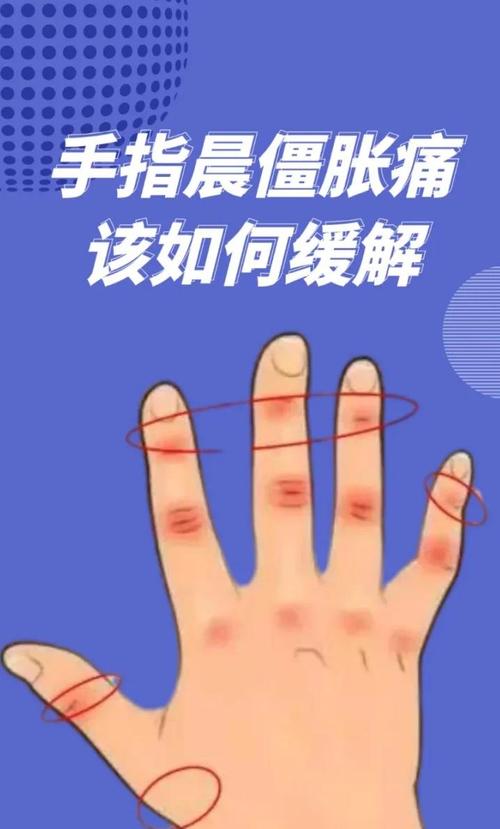 痛风会手指关节疼吗