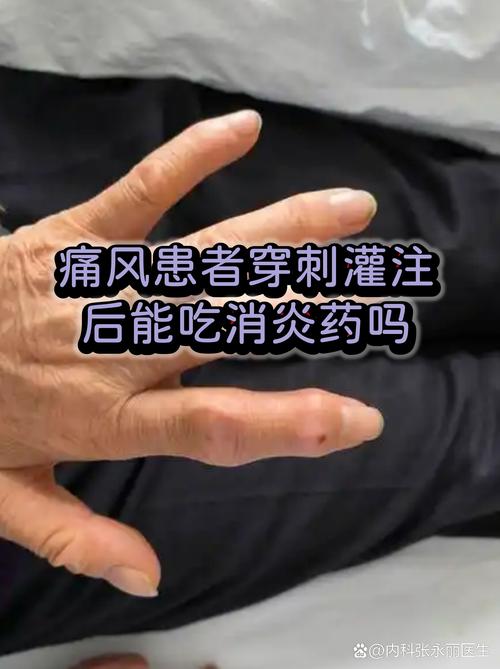 权健痛风药是真的吗