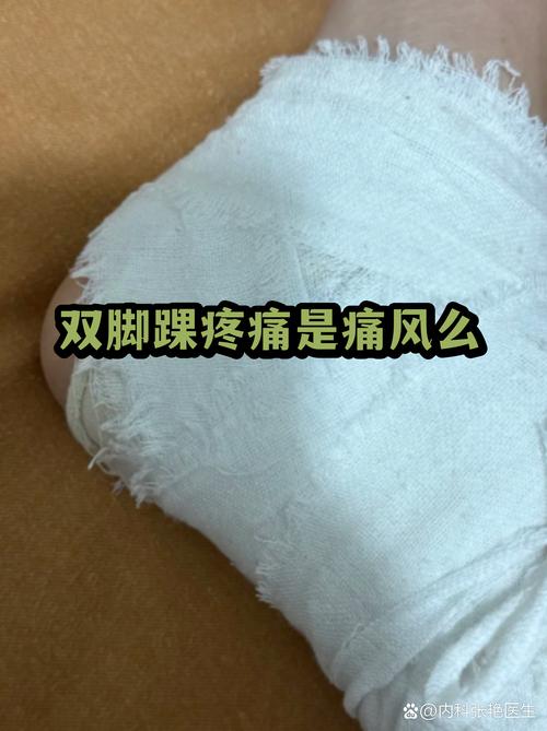 脚脖子筋疼是痛风吗
