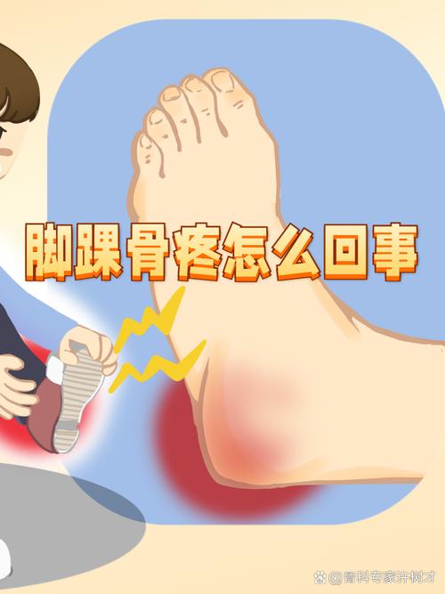 脚脖子筋疼是痛风吗