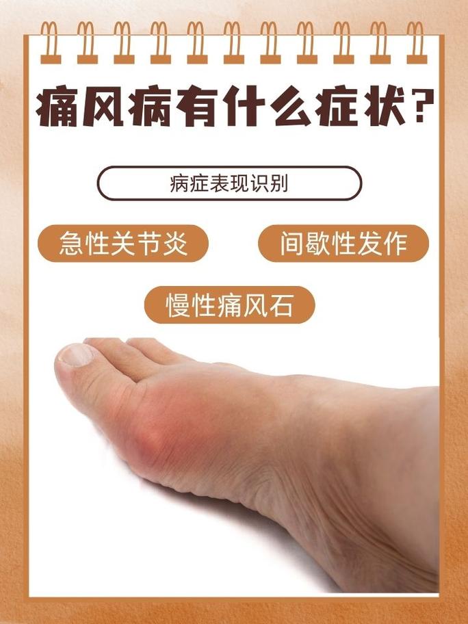 痛风关节炎能治疗吗