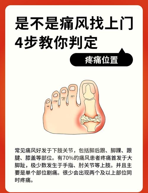 痛风一般几天能走路