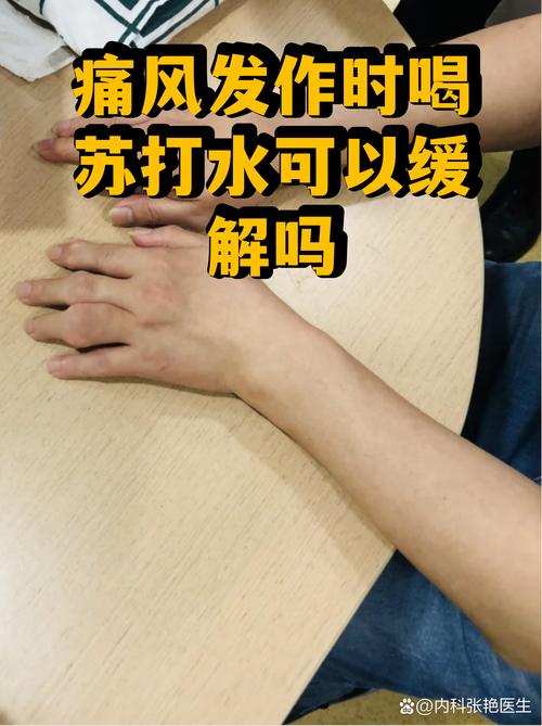痛风可以和苏打水吗