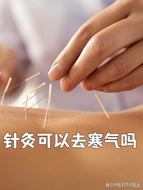 针灸可以打通经络吗
