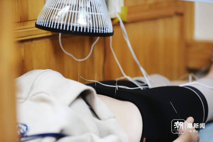 大兴中医院针灸减肥