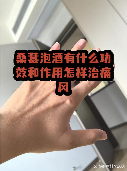 国康医院能治痛风吗