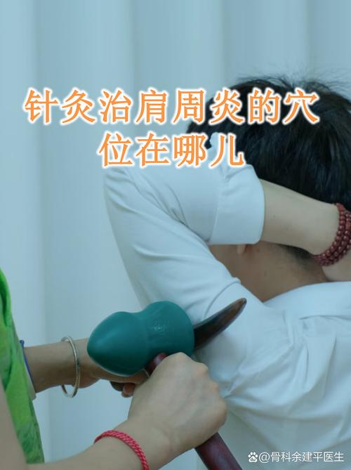 扎针灸能治肩周炎吗