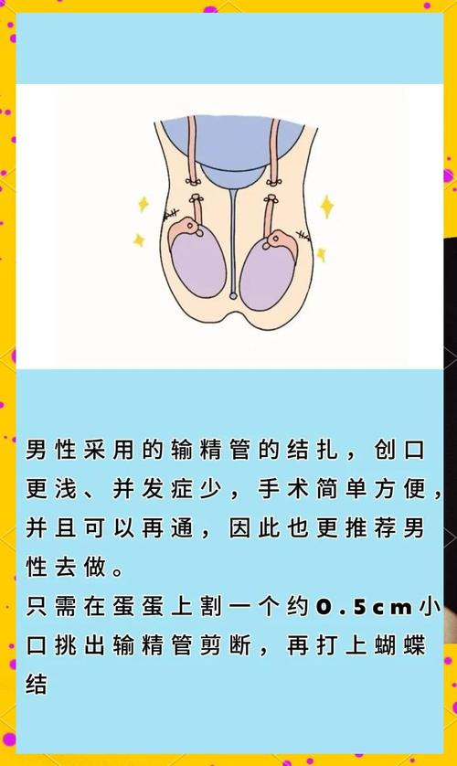 女性最安全的避孕方法