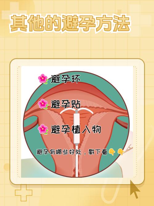 女性最安全的避孕方法