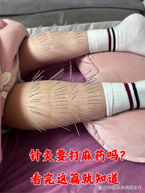 针灸后会有什么反应