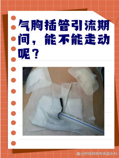 肺脓肿穿刺引流安全吗