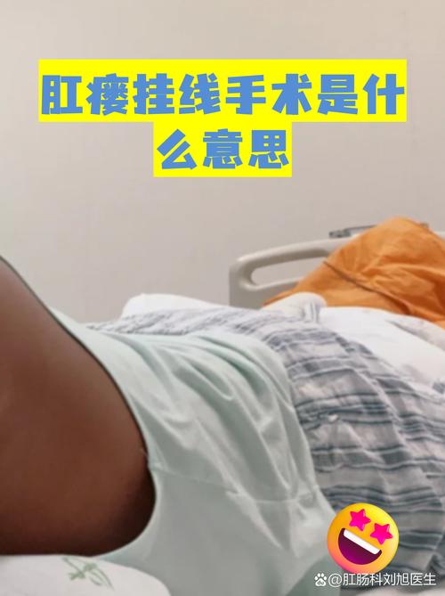 针灸可以治疗肛瘘吗