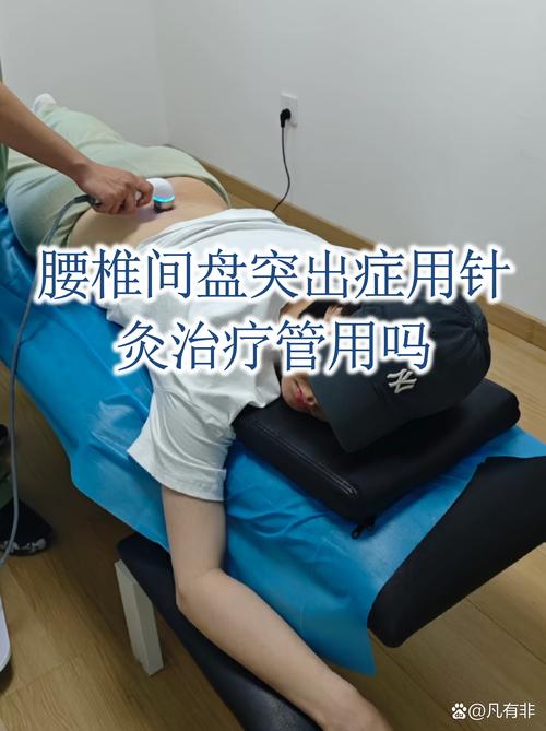 骨盆不正针灸能矫正