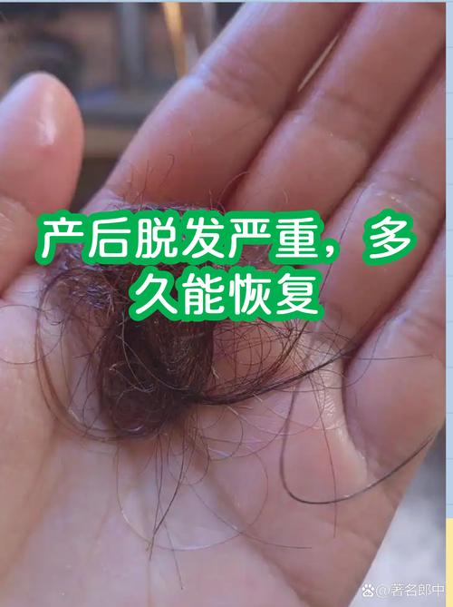 哈尔滨脱发医学会安全