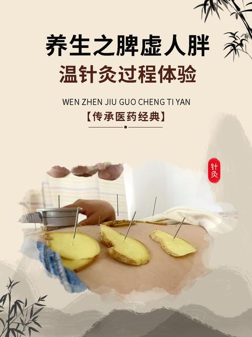 南昌姜医师针灸减肥
