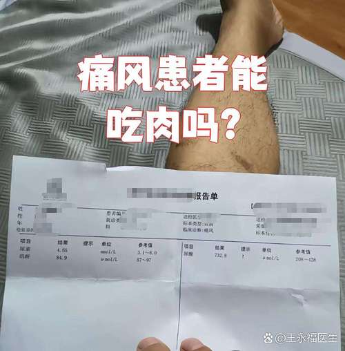痛风急性期能吃肉吗