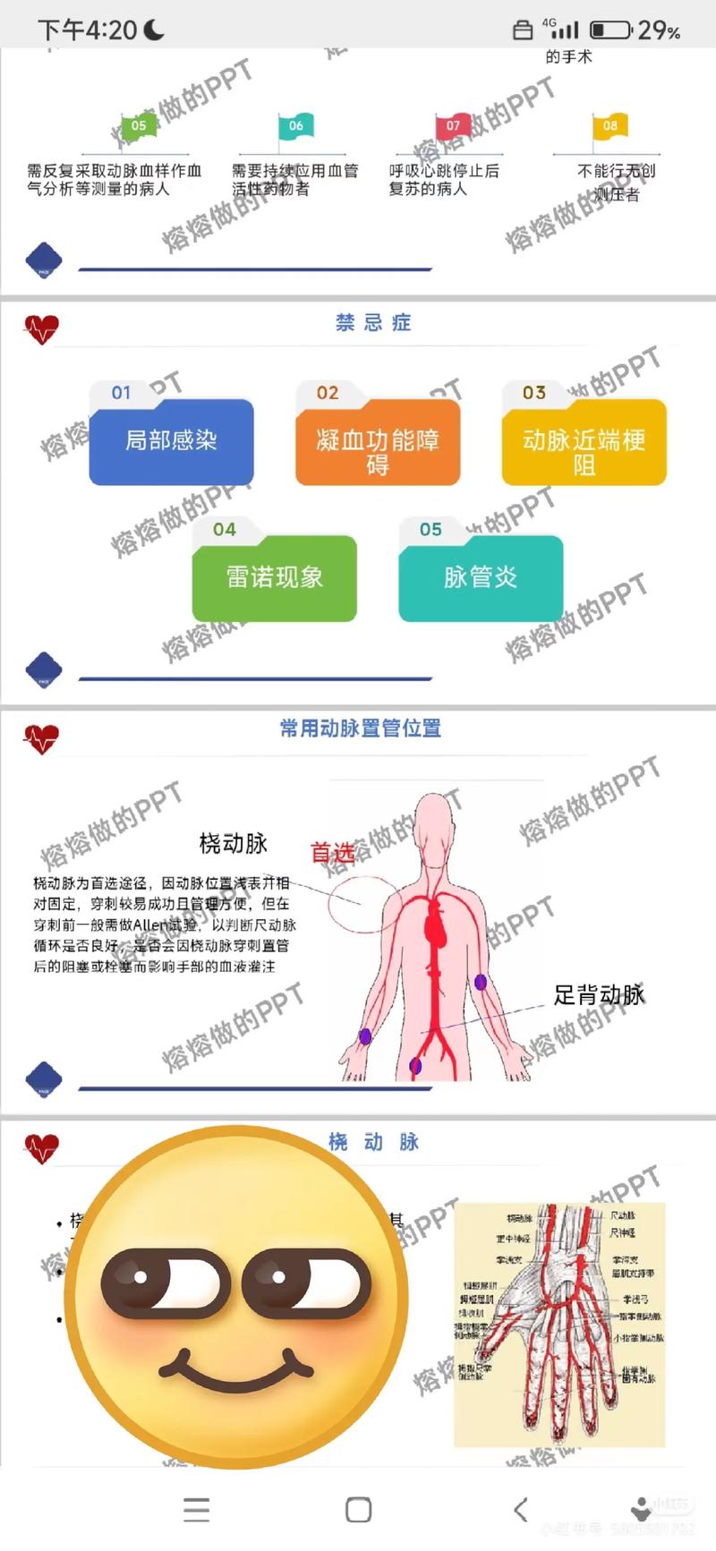 穿刺浅静脉安全的原因