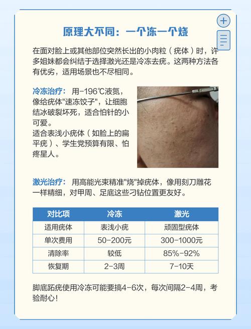 激光和冷冻哪个更安全