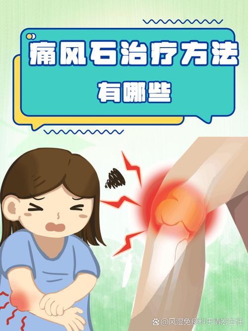 痛风石按下去会痛吗