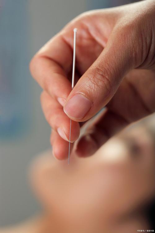 广州哪里可以学针灸