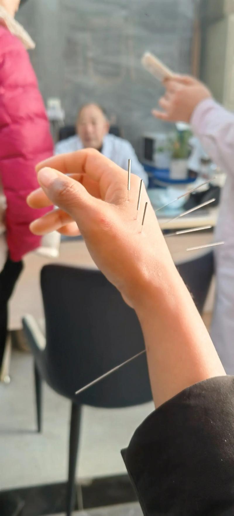 广州哪里可以学针灸