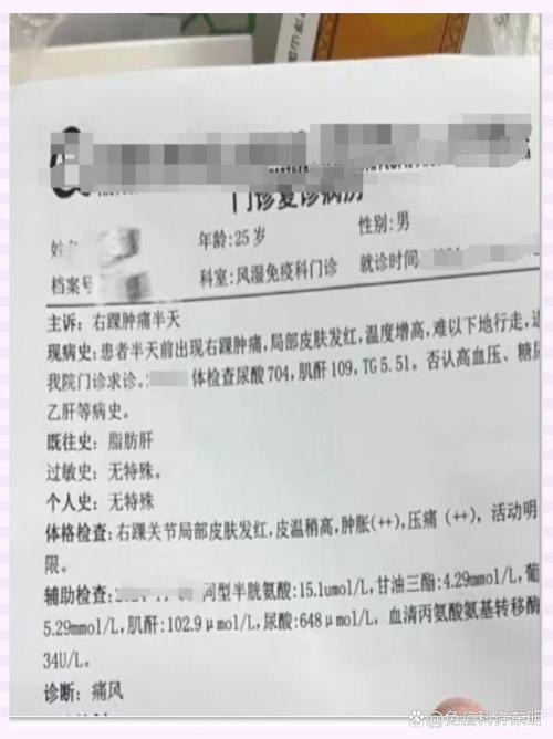 痛风发作能吃香蕉吗