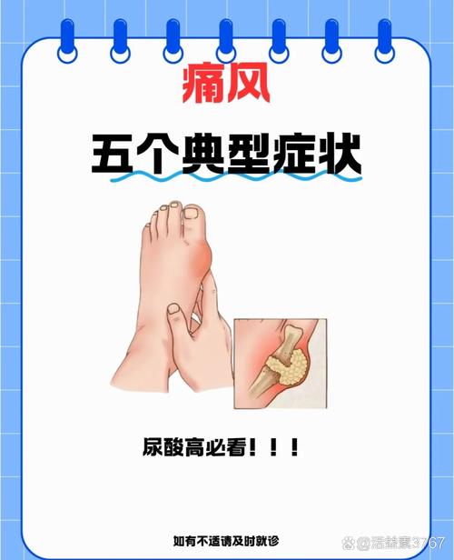 痛风病的症状及治疗