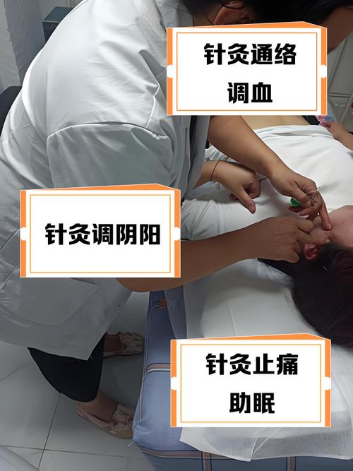 不同的医生针灸好吗
