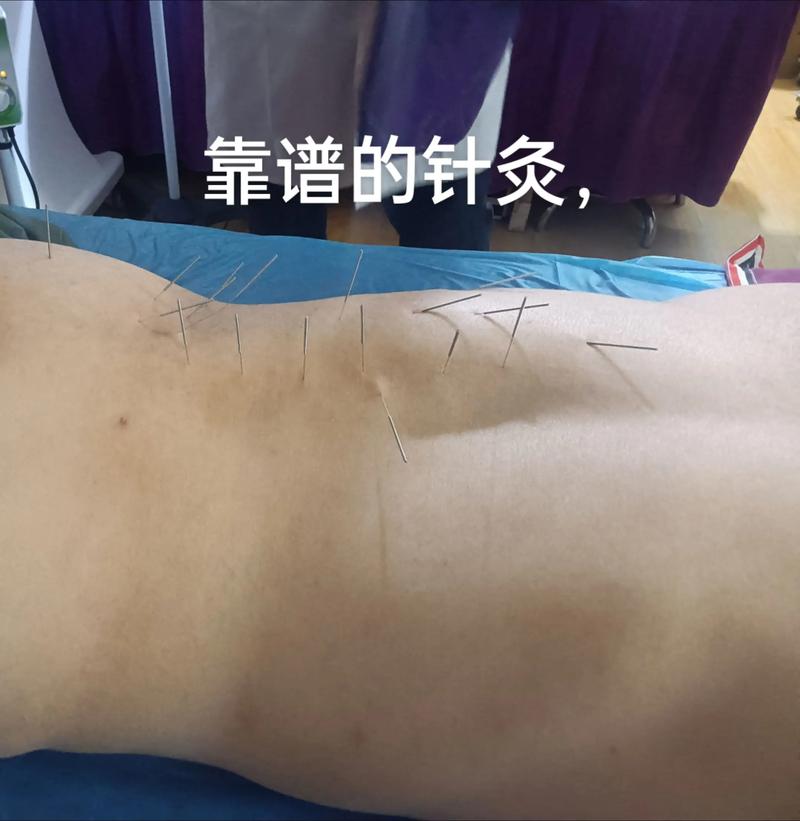 西安哪里有中医针灸