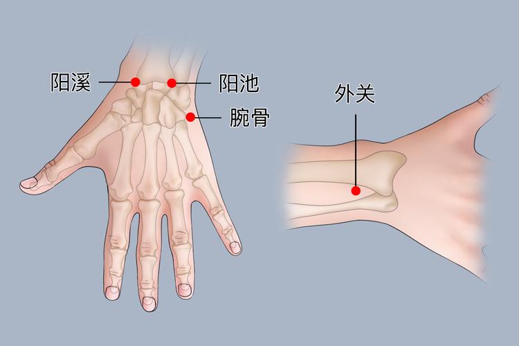 手腕疼痛的针灸方法