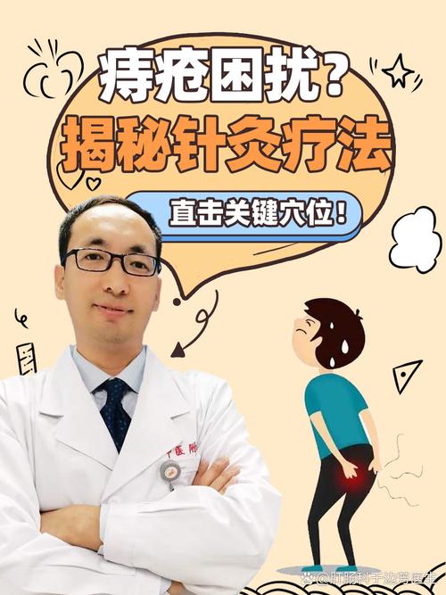 针灸治痔疮效果好吗