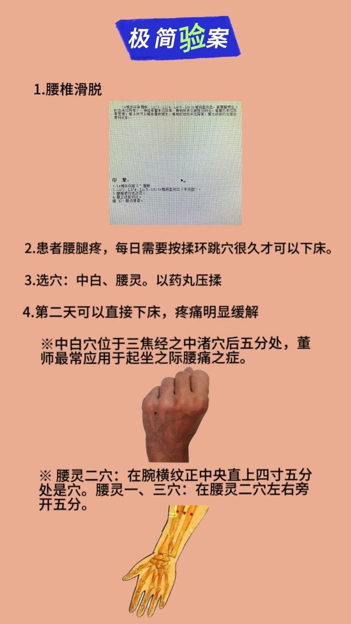 针灸绝技治腰椎滑脱